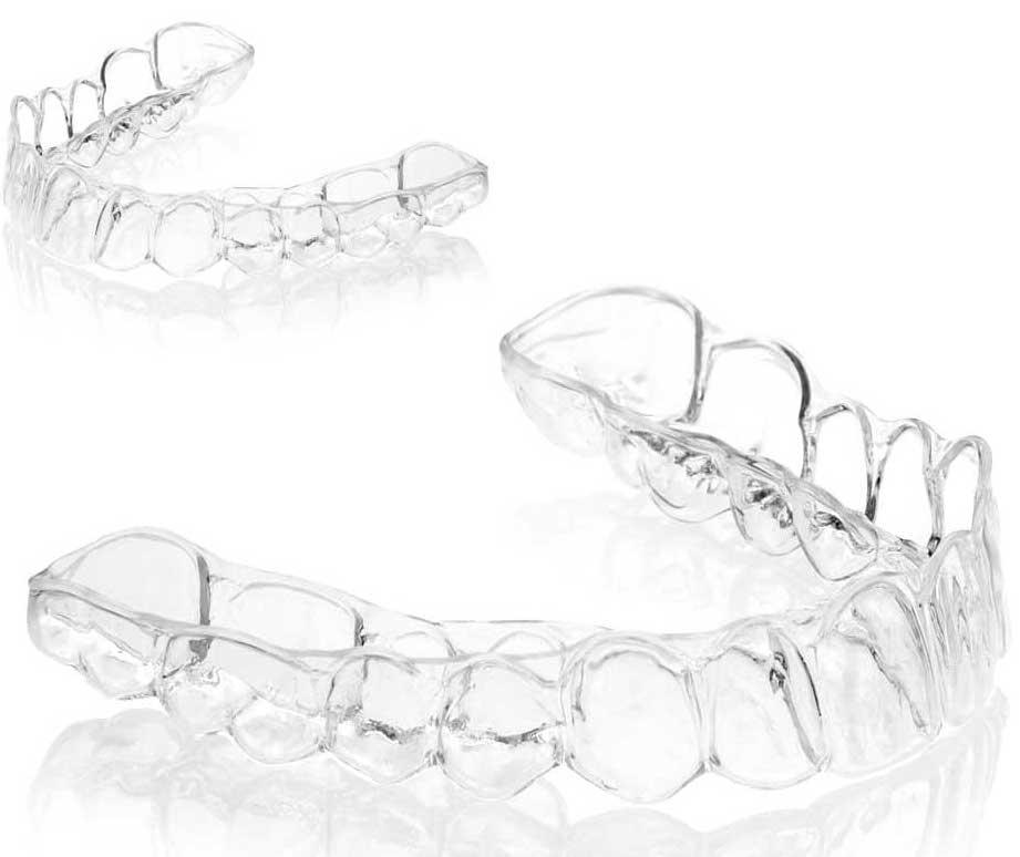 Invisialign, clear aligners cost in India