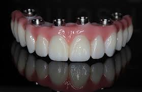 zirconia fixed tooth cost India