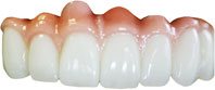 acrylic-teeth-with-titanium-india-chennai-tamil-nadu